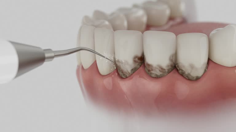 Reliable Dental Implants contractor in Colton, CA by Smile Center Dentistry